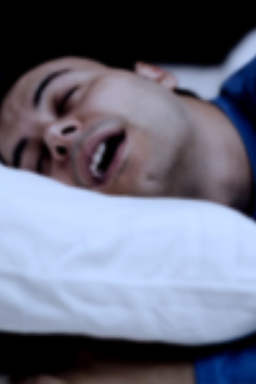 Obstructive sleep apnea (OSA) in adults