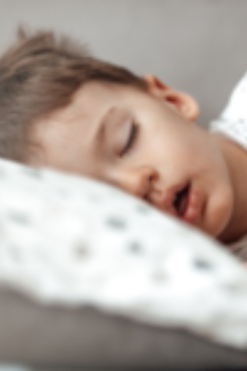 Obstructive sleep apnea (OSA) in children